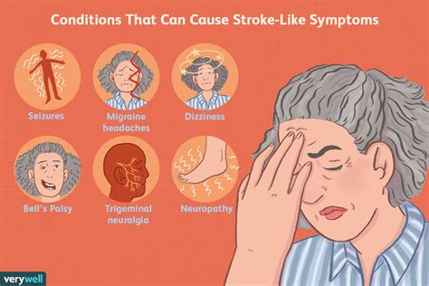 Mini Stroke Tia Stroke Causes Symptoms Signs Treatmen Vrogue Co