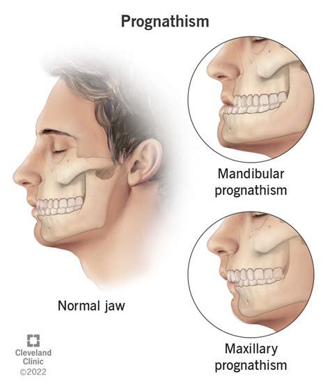 What Do Long Canine Teeth Mean