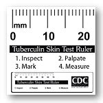 Tuberculin Skin Test Ruler Printable NaturalSkins
