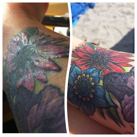 Tattooallergy Before And After Three Months Of Steroid Shots Into