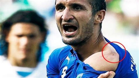 Check spelling or type a new query. Luis Suarez: Soal Gigitan Tak Usah Dibesar-besarkan ...