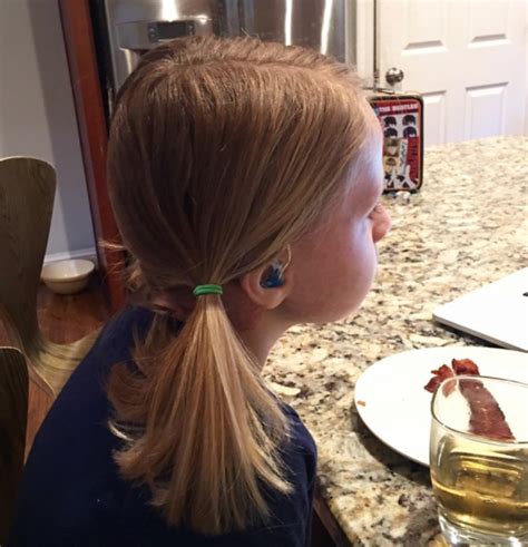 The Inspiring Story Of A Brave 7 Year Old Her Pigtails
