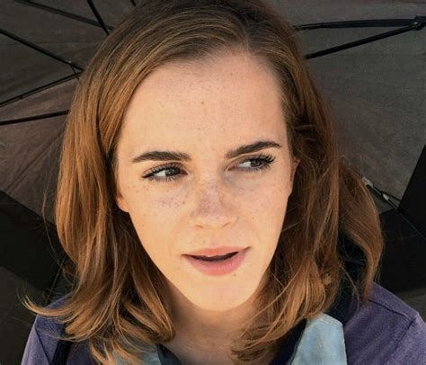 Emma Watson — More Freckles Via Remmawatson