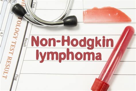 Non Hodgkin Lymphoma History