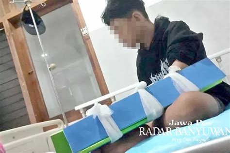 Diolok Olok Kemudian Dihajar Teman Sekolah Siswa Smp Alami Patah Tulang Radar Banyuwangi