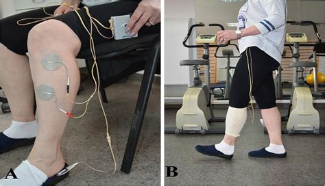 Effects Of Biofeedback Versus Switch Triggered Functional Electrical Stimulation On Sciatica