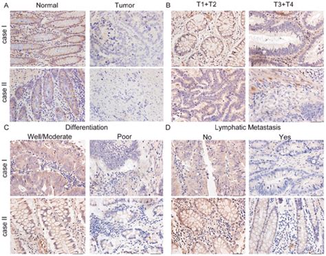 Representative Immunohistochemical Staining For Col1a2 Expression In