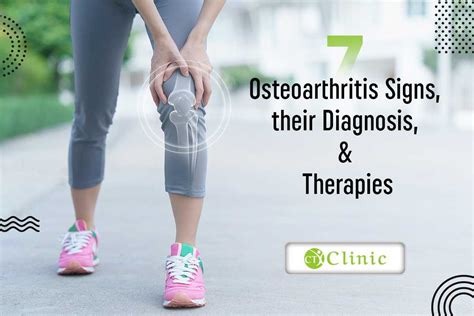 7 Osteoarthritis Signs Their Diagnosis And Therapies Ct Clinic