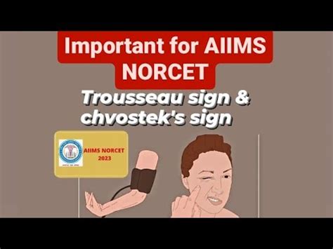Chvostek S Sign Or Trousseau S Sign Hypocalcaemia Cause ESIC NORCET
