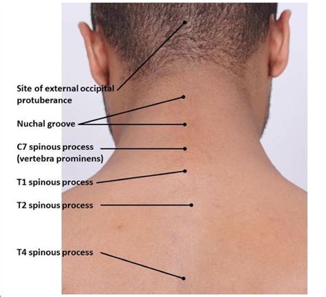 Palpable Lump Back Of Neck When Tilting Head Things You Didnt Know
