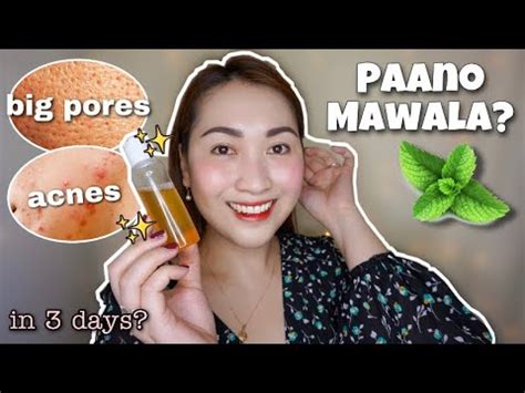 PAANO MAWALA MGA PIMPLES OILY SKIN BIG PORES GAMIT ANG ASTRINGENT NA