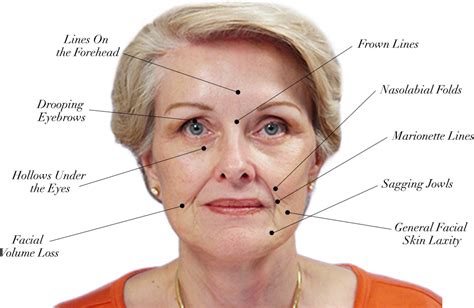 Facial Anatomy Skin Anatomical Charts And Posters
