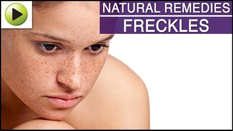 Skin Care Freckles Natural Ayurvedic Home Remedies Youtube
