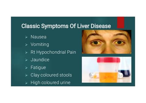 Liver disease has many causes. Signs and Symptoms of Liver Diseases
