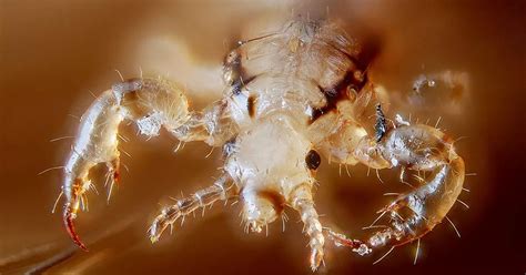 This Is The Worst Possible Head Lice Infestation Ever Mirror Online