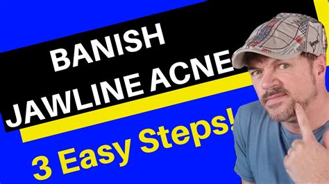 Jawline Acne 3 Easy Steps To Stop Jawline Acne Chris Gibson Youtube