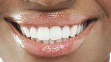 Combatting Gum Disease In The Big Easy Your Guide To Oral Health In New Orleans General