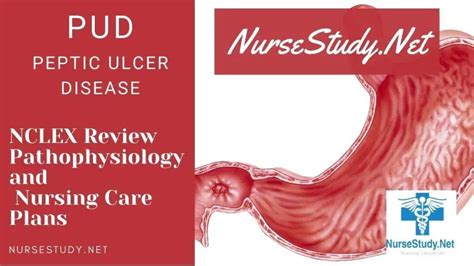 Peptic Ulcer Disease Nursing Diagnosis