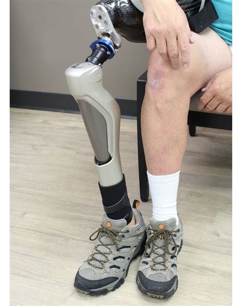 Prosthetic Leg Types Hot Sex Picture