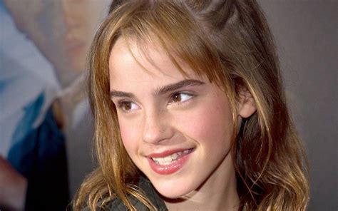 Emma Watson Braces