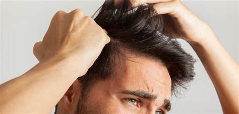 Details Reasons For Excessive Hair Fall Best Ceg Edu Vn