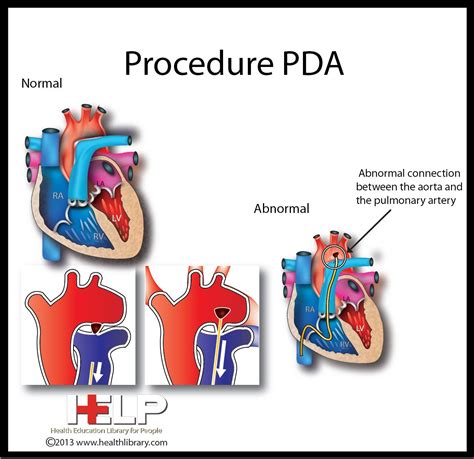 There's a time and a place for a. Pin by Diane Kowalik on Heart s | Heart patient ...