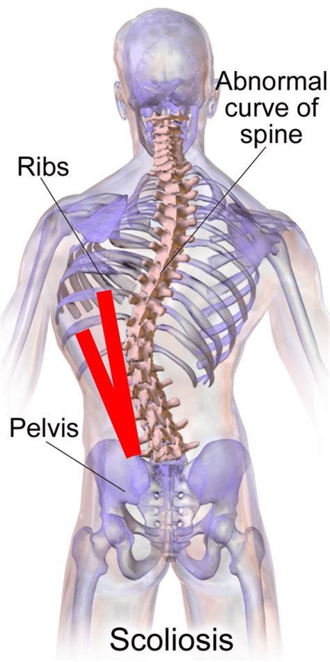 What Causes Back Rib Pain Regenexx
