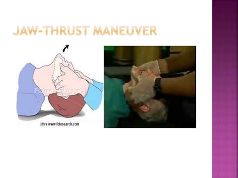 Manobra Chin Lift E Jaw Thrust