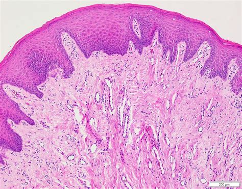 Buccal Mucosa Histology