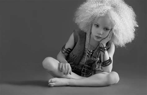 Albino Models And Black Women Hairstyles Hairstyle 2017