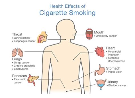 The Pathophysiology Of Smoking And Heart Attack Pristyn Care