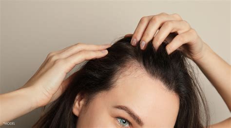 The Secret To Healthy Hair It All Starts With A Healthy Scalp Sba