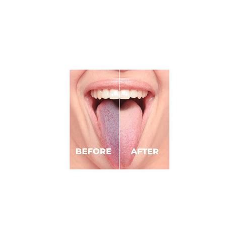 Tongue scraping isn't as unpleasant as it sounds. Tongue Scraper Cashback Rebates - RebateKey