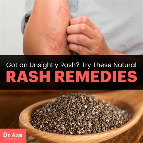 How To Get Rid Of A Rash 6 Natural Rash Remedies Dr Axe Natural