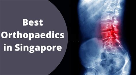 The Best Orthopaedics In Singapore Guide 2023 Globally Info