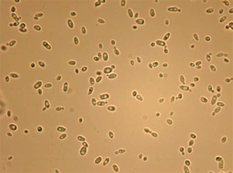 Microscopic Morphologic Features Of Yeast Medical Laboratories