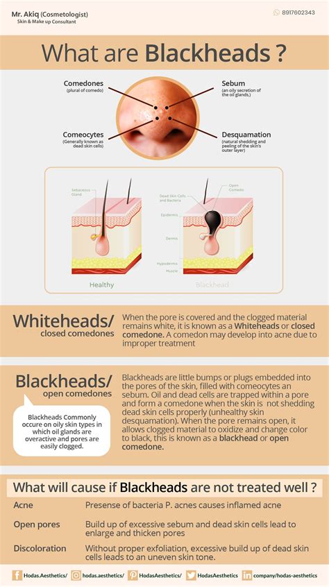 Clogged Hair Follicle Pulled Out Suellen Delatorre