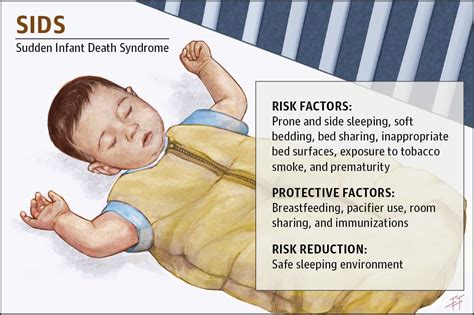 Reducing The Risk Of Sudden Infant Death Syndrome Patient Information