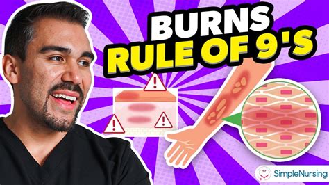 Burns Nursing Overview Rule Of Nines Types Causes Care Youtube
