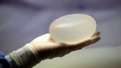 More Cases Are Reported Of Unusual Cancer Linked To Breast Implants