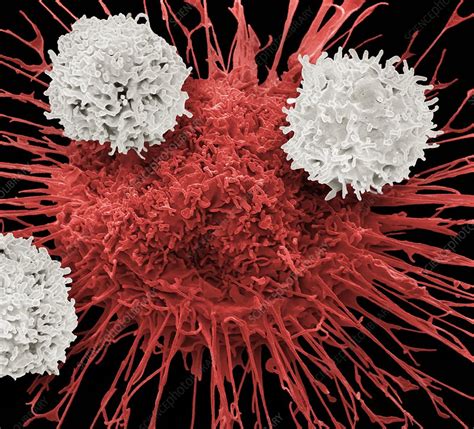 T Cells And Lung Cancer Cell SEM Stock Image C049 9000 Science