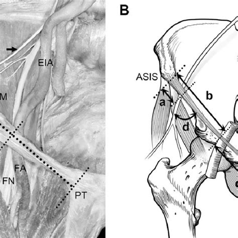 A Overview Of The Relationship Of The Lateral Femoral Cutaneous Nerve