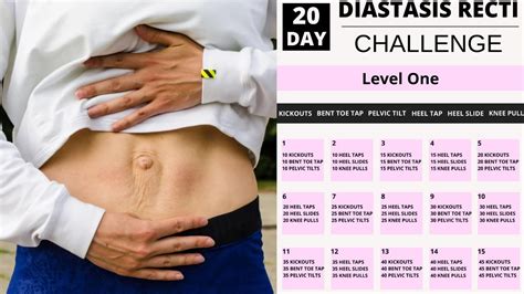 Free 20 Day Diastasis Recti Workout Challenge Level One Youtube