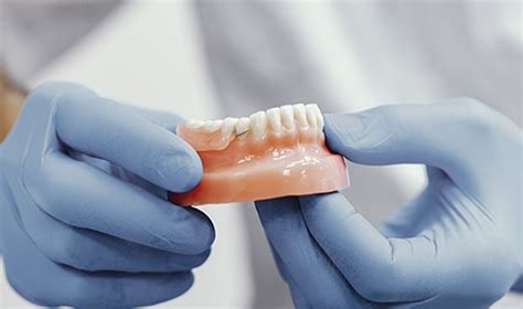 Noticia ¿qué Son Las Prótesis Dentales Removibles