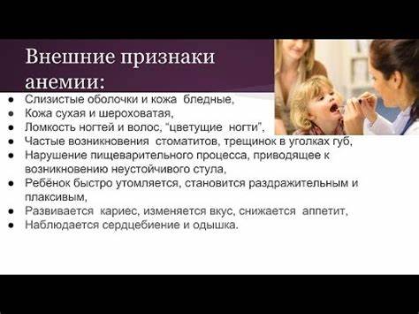 Анемия лечение диетой Анемия у детей.Профилактика и лечение. - YouTube Анемия у детей.Профилактика и лечение. - YouTube Анемия лечение диетой