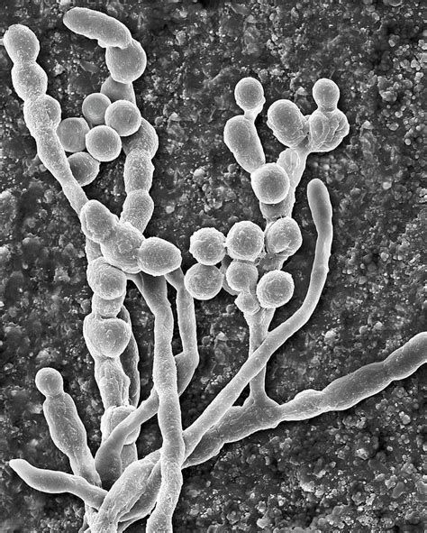 Mould Cladosporium Spp Hyphae And Spores Photograph By Dennis Kunkel