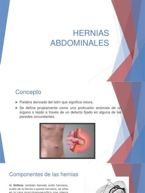 Hernias Abdominales Pdf Abdomen Medicina Clinica