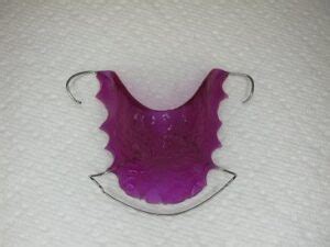 How long do retainers last? Your Markham Orthodontist, Toronto Invisalign, and ...