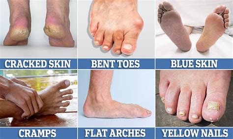 What Your Feet Say About Your Health And What Will Happen If You