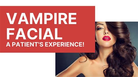 Vampire Facial Prp A Patient S Experience Everything You Need To Know Elite Aesthetics